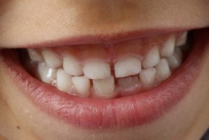 Pielęgnacja zębów – najczęściej popełniane błędy
