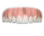 implanty zębów: brak pojedynczego zęba