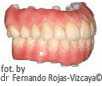 implanty zębów: Zirkonzahn® Prettau